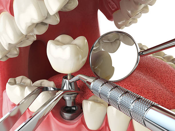 Best Emergency Gum Treatment in Nedrow, NY